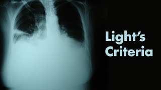 Lights Criteria amp Pleural Effusions  MEDZCOOL [upl. by Belter318]