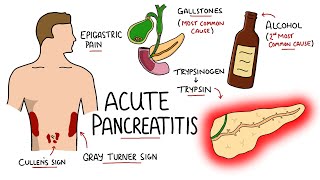 Bicarbonate secretion in the pancreatic duct cells [upl. by Jankell]