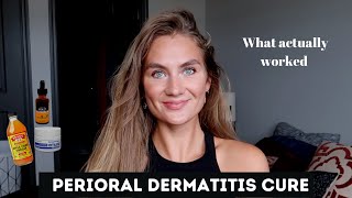 Perioral Dermatitis Treatment [upl. by Seessel]