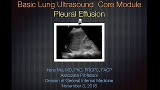 Pleural Effusion [upl. by Ednalrim]