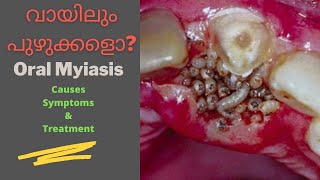 Myiasis [upl. by Gloriana]