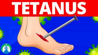 Tetanus Medical Definition  Quick Explainer Video [upl. by Terrence]