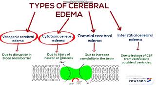 Cerebral edema [upl. by Aicenra]