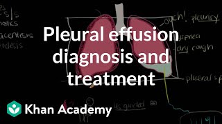 Pleural effusion diagnosis and treatment  Respiratory system diseases  NCLEXRN  Khan Academy [upl. by Gregorio]