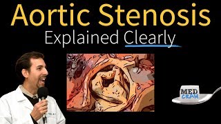 Mitral Valve Stenosis Explained Clearly  Pathophysiology Symptoms Treatment [upl. by Bertila]