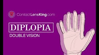 Diplopia and Double Vision  What Causes It and How is it Treated [upl. by Ecylla]