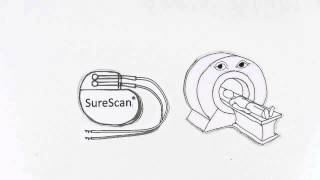 Medtronic SureScan® MRI [upl. by Fraase]