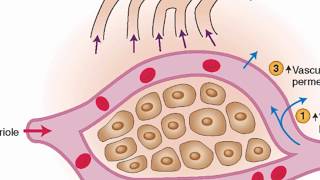 Mechanisms of edema development [upl. by Jordanna]