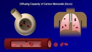 Your Spirometry Test English Version [upl. by Alial]