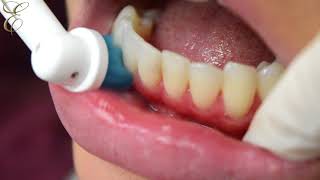 How to use electric tooth brush properly [upl. by Nawyt]