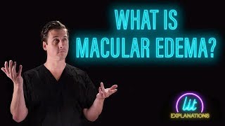 What Is Macular Edema [upl. by Cammie]