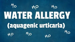 Water Allergy 10 Interesting Facts About Aquagenic Urticaria [upl. by Aerb]