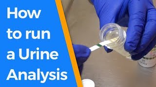 How to run a Urine Analysis [upl. by Kaitlyn850]